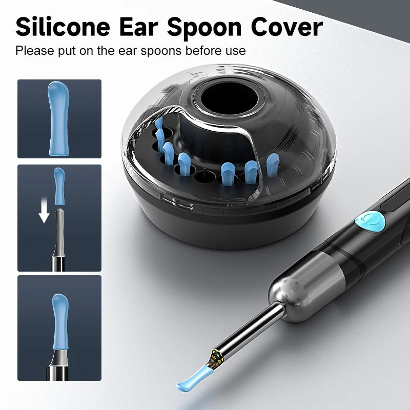 Antcam Wireless Visual Otoscope